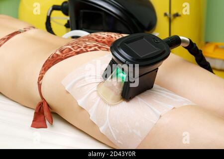 Donna che ottiene la procedura di trattamento del grasso di criolipolisi sull'anca in bellezza salone Foto Stock