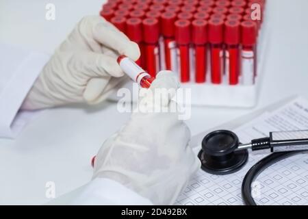 Il medico indiano esamina le fiale dei campioni di analisi del sangue dei pazienti durante la preparazione rapporto medico Foto Stock