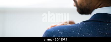 Uomo africano spazzolando Dandruff da vestito sporco Foto Stock