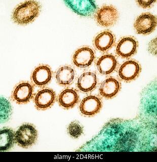 Particelle di virus dell'influenza suina micrografia elettronica a trasmissione colororizzata di A. Sezione trasversale delle particelle di virus dell'influenza SW31 (ceppo suina) (arancione) Foto Stock