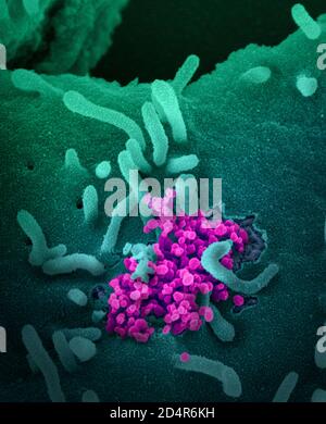 Novel Coronavirus SARS-COV-2Questa immagine al microscopio elettronico a scansione mostra SARS-COV-2 (oggetti magenta rotondi) che emergono dalla superficie delle cellule cultur Foto Stock
