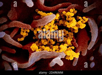 Questa immagine al microscopio elettronico a scansione mostra SARS-COV-2 (giallo), noto anche come 2019-nCoV, il virus che causa COVID-19, isolato da un paziente in t. Foto Stock