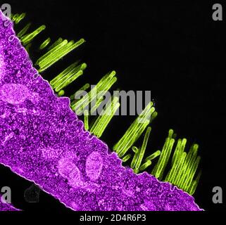 Particelle di virus dell'influenza suina micrografia elettronica a trasmissione colored di SW31 (ceppo suina) particelle di virus dell'influenza (verdi) che si protano dalla superficie Foto Stock