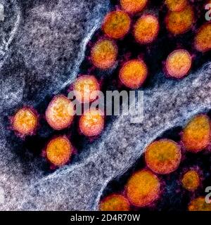Questa immagine al microscopio elettronico a trasmissione mostra SARS-COV-2, noto anche come 2019-nCoV, il virus che causa COVID-1, isolato da un paziente negli Stati Uniti Foto Stock