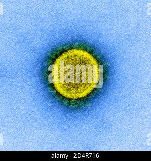 Questa immagine al microscopio elettronico a trasmissione mostra SARS-COV-2, noto anche come 2019-nCoV, il virus che causa COVID-1, isolato da un paziente negli Stati Uniti Foto Stock