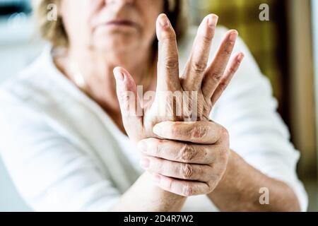 Senior donna che soffre di un dolore articolare in mano. Foto Stock