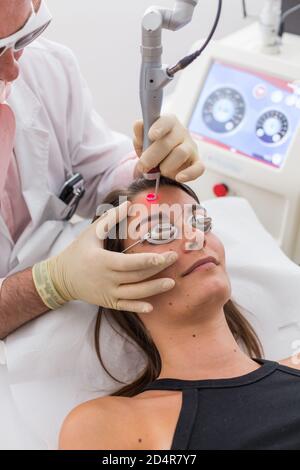 Laser vascolare utilizzato nel trattamento di acne rosacea e varicosity. Foto Stock