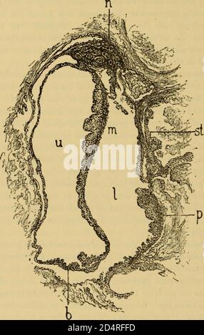 Un libro di testo le malattie dell'orecchio e organi adiacenti (1894) Foto Stock