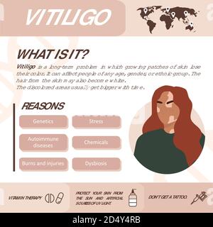 Infografiche di vitiligine. Motivi della malattia. Silhouette donna astratta. Concetto vettoriale per sostenere le persone che vivono con vitiligine e per costruire Illustrazione Vettoriale