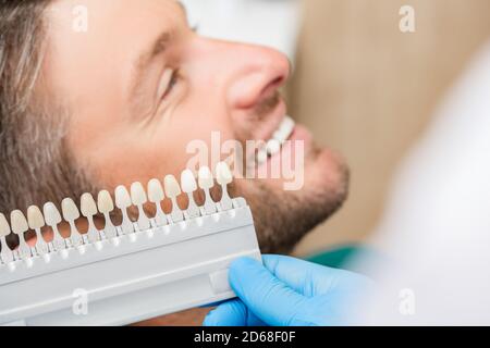 Il dentista utilizza un campione di colore dei denti della tavolozza per determinare l'ombra dei denti maschi del paziente. Lo stomatologo userà il colore dei denti per fare veneer, corone, Foto Stock