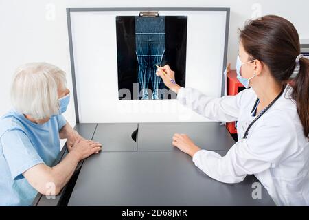 Reumatologo che consulta un paziente anziano puntando ai raggi X dell'articolazione del ginocchio. Artrite e malattia delle articolazioni delle gambe Foto Stock