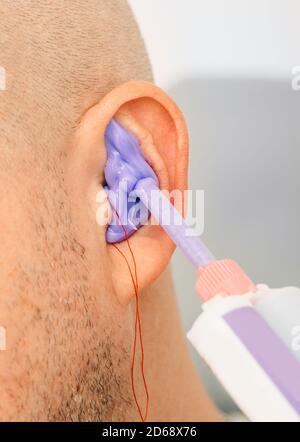 Processo di creazione di tappi auricolari da un'impressione dell'orecchio umano di un individuo. Primo piano dell'orecchio. Inserti auricolari sagomati personalmente. Soluzione per ambienti rumorosi. Parte o Foto Stock