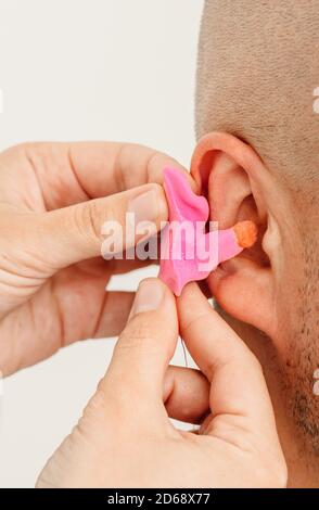 Processo di creazione di tappi auricolari da un'impressione dell'orecchio umano di un individuo. Primo piano dell'orecchio. Inserti auricolari sagomati personalmente. Soluzione per ambienti rumorosi. Parte o Foto Stock