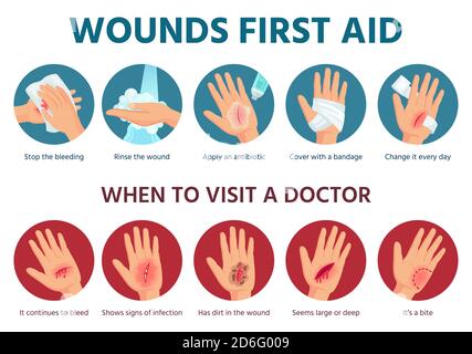 Pronto soccorso per ferite sulla pelle. Procedura di trattamento per il taglio di spurgo. Bendaggio su palmo ferito. Infografica sulla sicurezza della situazione di emergenza in vettore Illustrazione Vettoriale