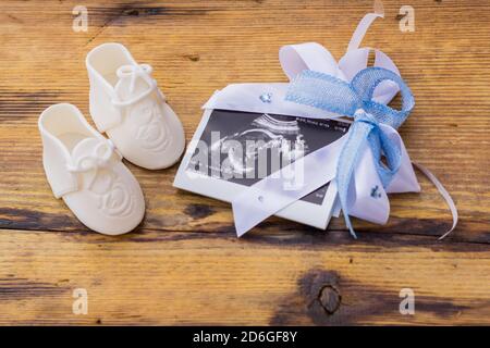 Stivali bianchi per bambini con nastro blu immagine a ultrasuoni intorno alla superficie rustica in legno, concetto di rivelazione di genere o annuncio di gravidanza Foto Stock