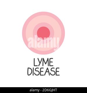 testo della malattia di lyme ed eritema migrans concetto rash- illustrazione vettoriale Illustrazione Vettoriale