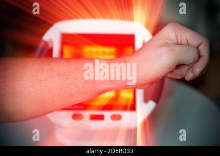 Uomo che cura il dolore in mano con la terapia a raggi infrarossi. L'uomo si siede al tavolo vicino alla lampada di guarigione. Foto Stock