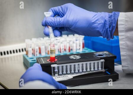 Elaborazione dei test FilmArray BioFire ®. Questo test fornisce risultati affidabili per l'identificazione di 23 bersagli (virus e batteri) responsabili f Foto Stock