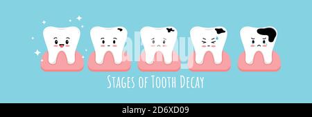 Fasi di decadimento dei denti in set di icone gengive. Illustrazione Vettoriale