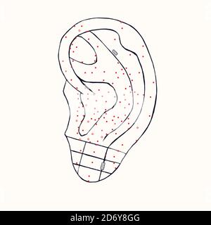 Schema di agopuntura dell'orecchio con punti rossi, doodle disegnato a mano, disegno in stile pop art, illustrazione medica in bianco e nero Foto Stock