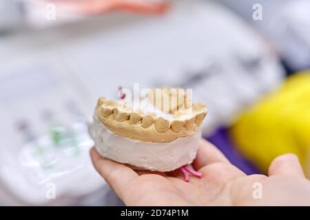 Gesso modello di denti della mascella, dentista sfondo ufficio Foto Stock