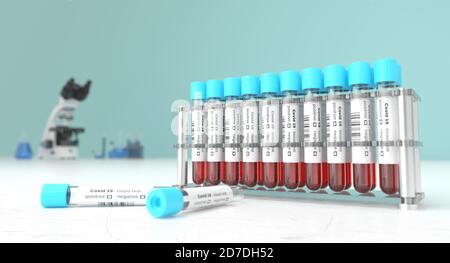 Analisi del sangue del coronavirus in un laboratorio per Covid-19 . Screening medico Covid. Campioni di sangue in provette in vetro. rendering 3d. Foto Stock