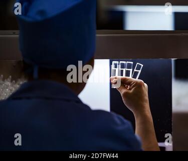 Shymkent/Kazakhstan - Aprile 27 2012: Impianto chimico farmaceutico. QC delle fiale di vetro. Produzione di forma di dosaggio liquida. Foto Stock