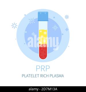 Trattamento con PRP (plasma ricco di piastrine), illustrazione concettuale. Foto Stock