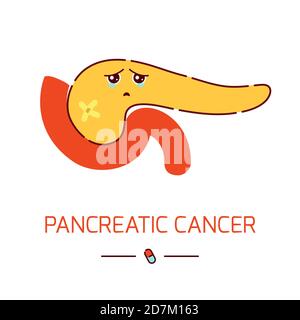 Poster sulla consapevolezza del cancro del pancreas, illustrazione concettuale. Foto Stock