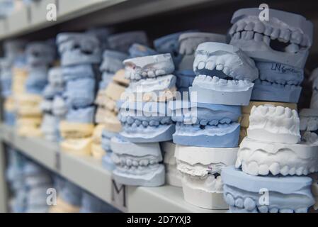 Luogo di deposito di modelli di gesso di mascelle umane in una clinica ortodontica. Controllo e diagnostica dei cilindri dentali Foto Stock