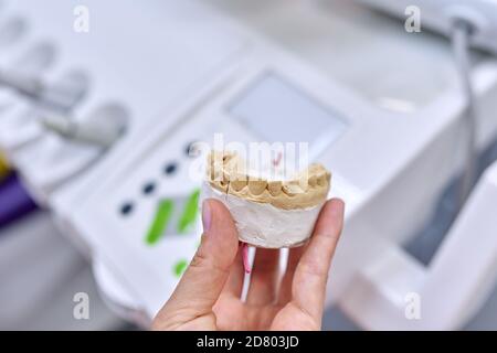 Gesso modello di denti della mascella, dentista sfondo ufficio Foto Stock