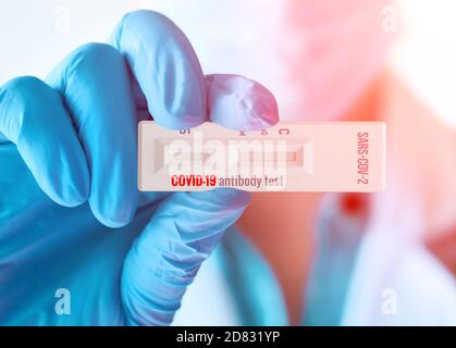 Il medico mostra un test di laboratorio rapido COVID-19 per la rilevazione di anticorpi IgM e IgG contro il nuovo Coronavirus, SARS-COV-2. Foto Stock