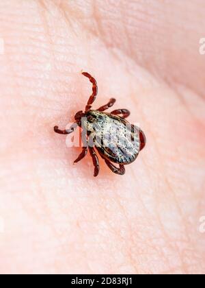 Encefalite infettiva Tick Insect strisciando sulla pelle. Virus encefalite o malattia di Lyme borreliosi infezione Dermacentor Tick Arachnid parassita Macro Foto Stock