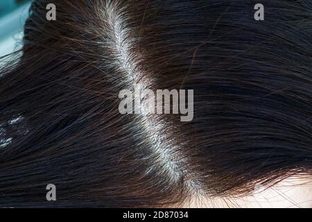 Testa da donna con capelli grigi, vista ravvicinata delle radici ricostruite. Foto Stock