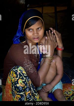 Una donna rifugiata Rohingya tiene il suo bambino il 16 aprile 2018 a Bazar di Cox, Bangladesh. Oltre 650,000 Rohingya hanno attraversato il confine con il Bangladesh dall’agosto dello scorso anno, in fuga dalle violenze. Foto Stock