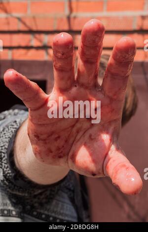 l'uomo si chiude dal fotografo con una mano sanguinosa. Una mano macchiata di sangue, primo piano. Fermare la violenza. Mani nel sangue. La lotta contro la crudeltà. Problemi sociali di abuso, violenza, crudeltà. Foto Stock