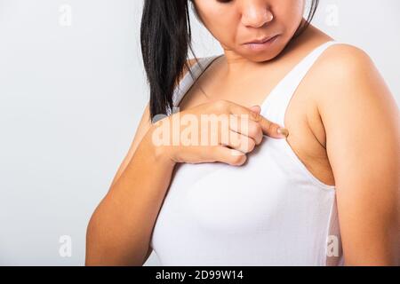 Primo piano di donna asiatica che punta la sua pelle ascella problema ascella grasso ascellare pelle rugosa, problema ascella pelle, studio isolato su bianco backgr Foto Stock