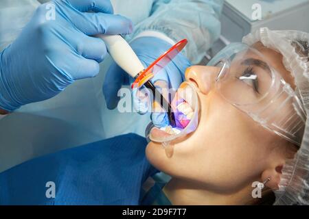 Dentista facendo la procedura con per indurimento dentale luce UV in clinica Foto Stock