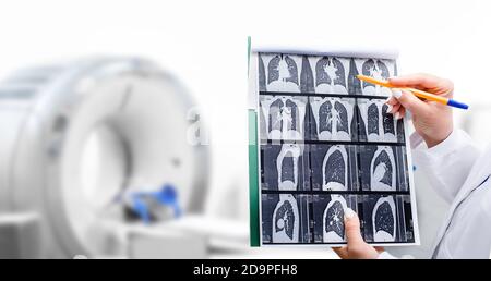 Radiologo che mostra la scansione tomografica dei polmoni di un paziente sopra la macchina TC. Trattamento di malattie polmonari, polmonite, coronavirus, covide, cancro, tuberco Foto Stock