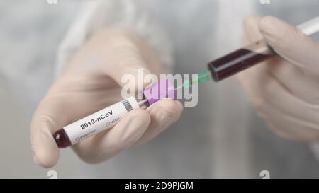 Un medico esamina la provetta del sangue per il coronavirus in laboratorio. Provetta per test con coronavirus. Foto Stock