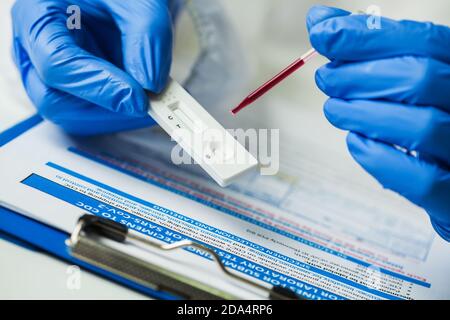 Ricercatore di laboratorio che esegue un test diagnostico rapido RDT per gli anticorpi anti- Rilevare la presenza di antigeni proteici virali espressi dalla corona COVID-19 virus Foto Stock