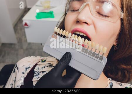 Primo piano ritratto di giovani donne in sedia dentista, controllare e selezionare il colore dei denti. Il dentista fa il processo di trattamento nella clinica dentale Foto Stock