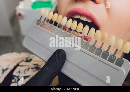 Primo piano ritratto di giovani donne in sedia dentista, controllare e selezionare il colore dei denti. Il dentista fa il processo di trattamento nella clinica dentale Foto Stock