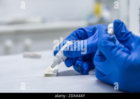 Mani di un infermiere con dispositivi di protezione individuale e paziente, in fase di raccolta del sangue per effettuare un test rapido per la covid-19(coronavirus), Foto Stock