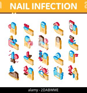 Malattie delle infezioni delle unghie icone isometriche Imposta vettore Illustrazione Vettoriale