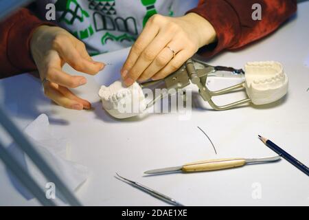 Un dentista sta lavorando su un cast di un paziente mascella dentale per creare un dente protesico Foto Stock