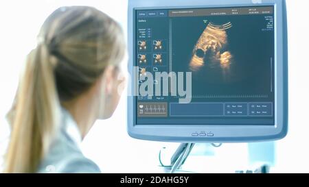 In ospedale, l'ostetrista utilizza il trasduttore per la scansione ecografica dello screening ecografico ventaglio della donna incinta. Lo schermo del computer mostra l'immagine 3D Foto Stock