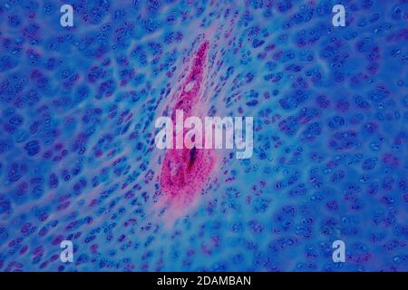 Cartilagine ialina umana, micrografia leggera. Foto Stock