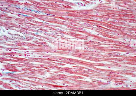 Muscolo cardiaco umano, micrografia leggera. Foto Stock