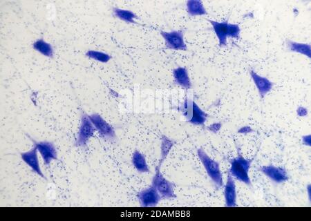 Micrografia chiara delle cellule nervose (grandi, blu) e delle cellule di supporto (neuroglia, punti blu scuro). Ramificazione dal corpo nervo sono dendriti. Foto Stock